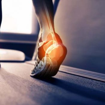 درمان درد پاشنه پا با فیزیوتراپی