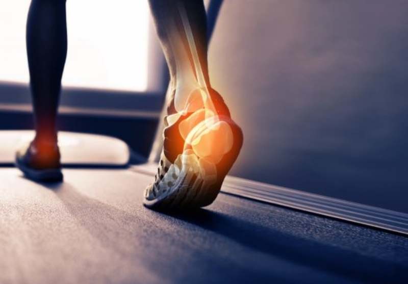 درمان درد پاشنه پا با فیزیوتراپی