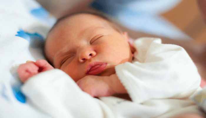 تشخیص کرن ایکتروس در نوزاد
