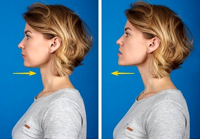 روش از بین بردن غبغب